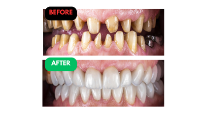 Gina Before and After