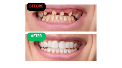 Esperanza Before and After